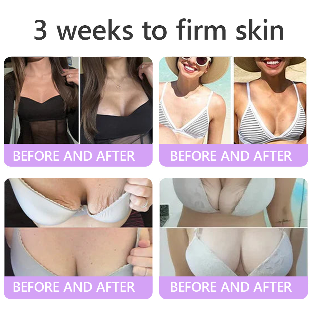 𝐇𝐈𝐒𝐊𝐈𝐍® 𝐏𝐃𝐑𝐍 𝐌𝐮𝐥𝐭𝐢-𝐏𝐞𝐩𝐭𝐢𝐝𝐞 𝐌𝐚𝐬𝐬𝐚𝐠𝐢𝐧𝐠 𝐁𝐨𝐝𝐲 𝐑𝐨𝐥𝐥𝐞𝐫 𝐂𝐫𝐞𝐚𝐦- 𝐀𝐧𝐭𝐢-𝐚𝐠𝐢𝐧𝐠, 𝐇𝐲𝐝𝐫𝐚𝐭𝐢𝐧𝐠, 𝐒𝐤𝐢𝐧 𝐅𝐢𝐫𝐦𝐢𝐧𝐠 & 𝐋𝐢𝐟𝐭𝐢𝐧𝐠, 𝐒𝐤𝐢𝐧 𝐑𝐞𝐩𝐚𝐢𝐫, 𝐄𝐯𝐞𝐧 𝐓𝐨𝐧𝐞, 𝐀𝐜𝐧𝐞 𝐚𝐧𝐝 𝐃𝐚𝐫𝐤 𝐒𝐩𝐨𝐭 𝐓𝐫𝐞𝐚𝐭𝐦𝐞𝐧𝐭, 𝐖𝐚𝐫𝐭 𝐚𝐧𝐝 𝐌𝐨𝐥𝐞 𝐑𝐞𝐦𝐨𝐯𝐚𝐥, 𝐚𝐧𝐝 𝐏𝐬𝐨𝐫𝐢𝐚𝐬𝐢𝐬 𝐑𝐞𝐥𝐢𝐞𝐟.