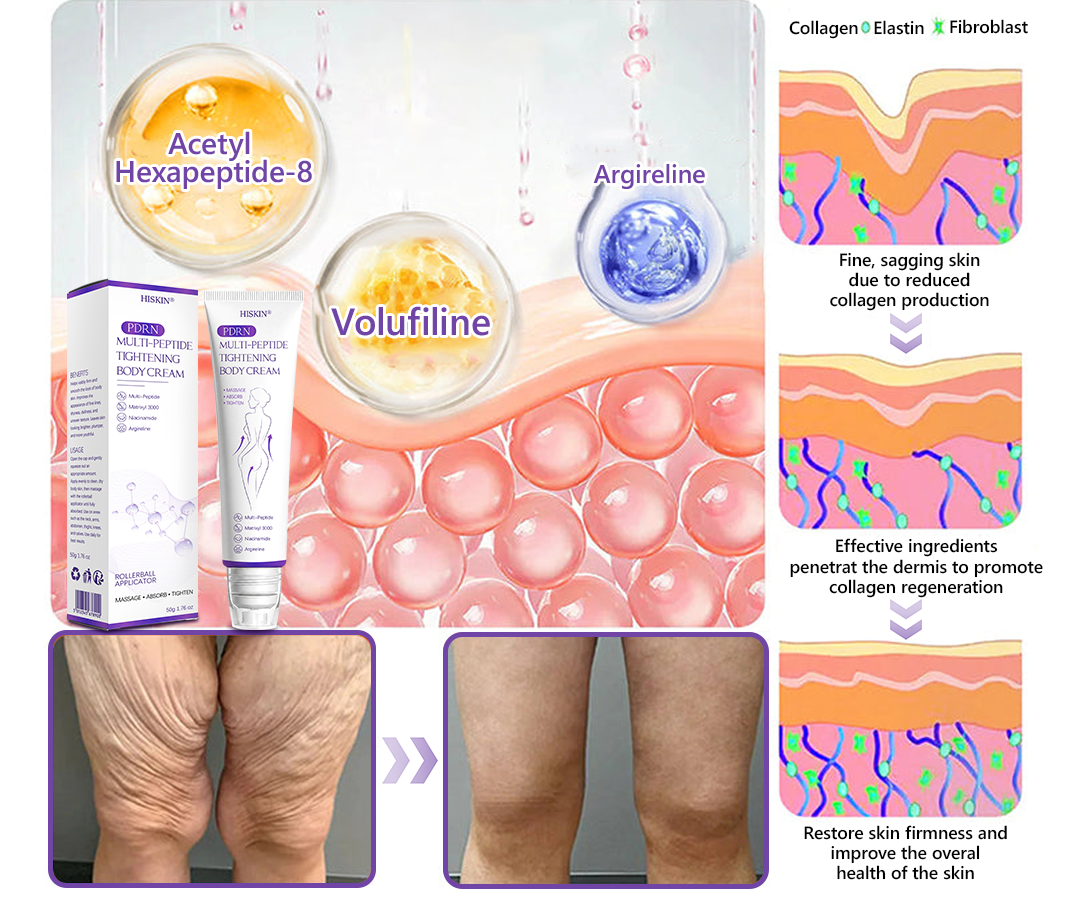 𝐇𝐈𝐒𝐊𝐈𝐍® 𝐏𝐃𝐑𝐍 𝐌𝐮𝐥𝐭𝐢-𝐏𝐞𝐩𝐭𝐢𝐝𝐞 𝐌𝐚𝐬𝐬𝐚𝐠𝐢𝐧𝐠 𝐁𝐨𝐝𝐲 𝐑𝐨𝐥𝐥𝐞𝐫 𝐂𝐫𝐞𝐚𝐦- 𝐀𝐧𝐭𝐢-𝐚𝐠𝐢𝐧𝐠, 𝐇𝐲𝐝𝐫𝐚𝐭𝐢𝐧𝐠, 𝐒𝐤𝐢𝐧 𝐅𝐢𝐫𝐦𝐢𝐧𝐠 & 𝐋𝐢𝐟𝐭𝐢𝐧𝐠, 𝐒𝐤𝐢𝐧 𝐑𝐞𝐩𝐚𝐢𝐫, 𝐄𝐯𝐞𝐧 𝐓𝐨𝐧𝐞, 𝐀𝐜𝐧𝐞 𝐚𝐧𝐝 𝐃𝐚𝐫𝐤 𝐒𝐩𝐨𝐭 𝐓𝐫𝐞𝐚𝐭𝐦𝐞𝐧𝐭, 𝐖𝐚𝐫𝐭 𝐚𝐧𝐝 𝐌𝐨𝐥𝐞 𝐑𝐞𝐦𝐨𝐯𝐚𝐥, 𝐚𝐧𝐝 𝐏𝐬𝐨𝐫𝐢𝐚𝐬𝐢𝐬 𝐑𝐞𝐥𝐢𝐞𝐟.