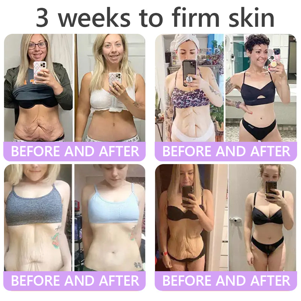 𝐇𝐈𝐒𝐊𝐈𝐍® 𝐏𝐃𝐑𝐍 𝐌𝐮𝐥𝐭𝐢-𝐏𝐞𝐩𝐭𝐢𝐝𝐞 𝐌𝐚𝐬𝐬𝐚𝐠𝐢𝐧𝐠 𝐁𝐨𝐝𝐲 𝐑𝐨𝐥𝐥𝐞𝐫 𝐂𝐫𝐞𝐚𝐦- 𝐀𝐧𝐭𝐢-𝐚𝐠𝐢𝐧𝐠, 𝐇𝐲𝐝𝐫𝐚𝐭𝐢𝐧𝐠, 𝐒𝐤𝐢𝐧 𝐅𝐢𝐫𝐦𝐢𝐧𝐠 & 𝐋𝐢𝐟𝐭𝐢𝐧𝐠, 𝐒𝐤𝐢𝐧 𝐑𝐞𝐩𝐚𝐢𝐫, 𝐄𝐯𝐞𝐧 𝐓𝐨𝐧𝐞, 𝐀𝐜𝐧𝐞 𝐚𝐧𝐝 𝐃𝐚𝐫𝐤 𝐒𝐩𝐨𝐭 𝐓𝐫𝐞𝐚𝐭𝐦𝐞𝐧𝐭, 𝐖𝐚𝐫𝐭 𝐚𝐧𝐝 𝐌𝐨𝐥𝐞 𝐑𝐞𝐦𝐨𝐯𝐚𝐥, 𝐚𝐧𝐝 𝐏𝐬𝐨𝐫𝐢𝐚𝐬𝐢𝐬 𝐑𝐞𝐥𝐢𝐞𝐟.