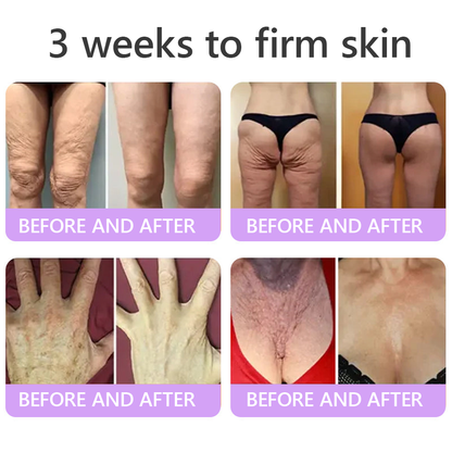 𝐇𝐈𝐒𝐊𝐈𝐍® 𝐏𝐃𝐑𝐍 𝐌𝐮𝐥𝐭𝐢-𝐏𝐞𝐩𝐭𝐢𝐝𝐞 𝐌𝐚𝐬𝐬𝐚𝐠𝐢𝐧𝐠 𝐁𝐨𝐝𝐲 𝐑𝐨𝐥𝐥𝐞𝐫 𝐂𝐫𝐞𝐚𝐦- 𝐀𝐧𝐭𝐢-𝐚𝐠𝐢𝐧𝐠, 𝐇𝐲𝐝𝐫𝐚𝐭𝐢𝐧𝐠, 𝐒𝐤𝐢𝐧 𝐅𝐢𝐫𝐦𝐢𝐧𝐠 & 𝐋𝐢𝐟𝐭𝐢𝐧𝐠, 𝐒𝐤𝐢𝐧 𝐑𝐞𝐩𝐚𝐢𝐫, 𝐄𝐯𝐞𝐧 𝐓𝐨𝐧𝐞, 𝐀𝐜𝐧𝐞 𝐚𝐧𝐝 𝐃𝐚𝐫𝐤 𝐒𝐩𝐨𝐭 𝐓𝐫𝐞𝐚𝐭𝐦𝐞𝐧𝐭, 𝐖𝐚𝐫𝐭 𝐚𝐧𝐝 𝐌𝐨𝐥𝐞 𝐑𝐞𝐦𝐨𝐯𝐚𝐥, 𝐚𝐧𝐝 𝐏𝐬𝐨𝐫𝐢𝐚𝐬𝐢𝐬 𝐑𝐞𝐥𝐢𝐞𝐟.