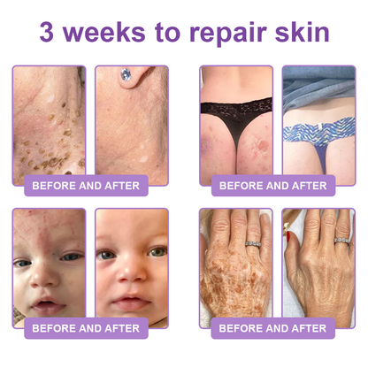 𝐇𝐈𝐒𝐊𝐈𝐍® 𝐏𝐃𝐑𝐍 𝐌𝐮𝐥𝐭𝐢-𝐏𝐞𝐩𝐭𝐢𝐝𝐞 𝐌𝐚𝐬𝐬𝐚𝐠𝐢𝐧𝐠 𝐁𝐨𝐝𝐲 𝐑𝐨𝐥𝐥𝐞𝐫 𝐂𝐫𝐞𝐚𝐦- 𝐀𝐧𝐭𝐢-𝐚𝐠𝐢𝐧𝐠, 𝐇𝐲𝐝𝐫𝐚𝐭𝐢𝐧𝐠, 𝐒𝐤𝐢𝐧 𝐅𝐢𝐫𝐦𝐢𝐧𝐠 & 𝐋𝐢𝐟𝐭𝐢𝐧𝐠, 𝐒𝐤𝐢𝐧 𝐑𝐞𝐩𝐚𝐢𝐫, 𝐄𝐯𝐞𝐧 𝐓𝐨𝐧𝐞, 𝐀𝐜𝐧𝐞 𝐚𝐧𝐝 𝐃𝐚𝐫𝐤 𝐒𝐩𝐨𝐭 𝐓𝐫𝐞𝐚𝐭𝐦𝐞𝐧𝐭, 𝐖𝐚𝐫𝐭 𝐚𝐧𝐝 𝐌𝐨𝐥𝐞 𝐑𝐞𝐦𝐨𝐯𝐚𝐥, 𝐚𝐧𝐝 𝐏𝐬𝐨𝐫𝐢𝐚𝐬𝐢𝐬 𝐑𝐞𝐥𝐢𝐞𝐟.